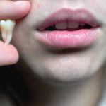 Що означає коли сниться що зуби випадають — страх втрат